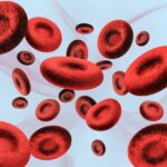 What is iron deficiency