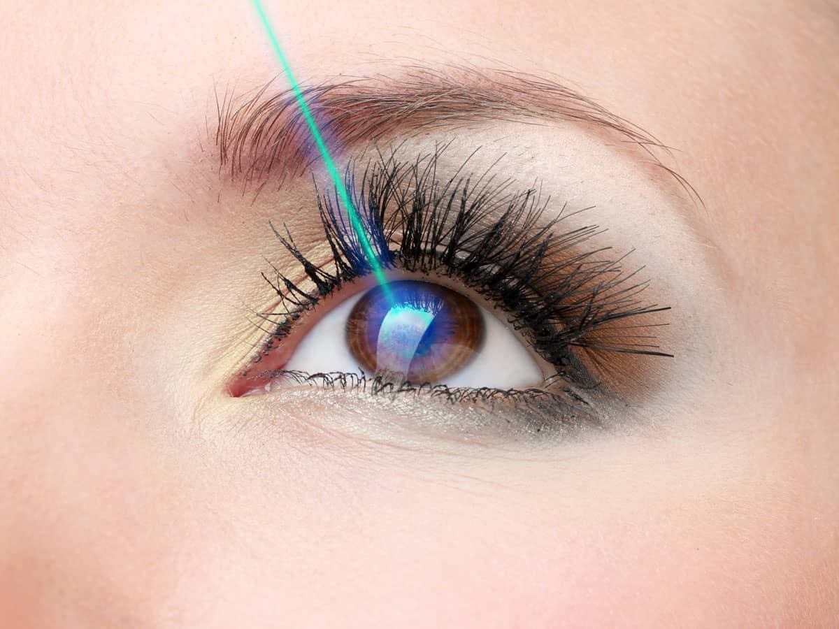 105 LASIKLaser Eye Surgery 03