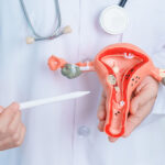 Endometriosis Symptoms and causes