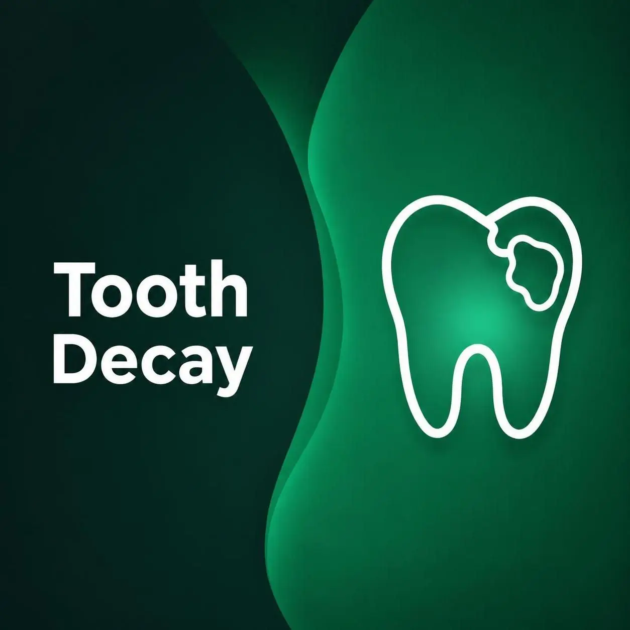 Tooth decay