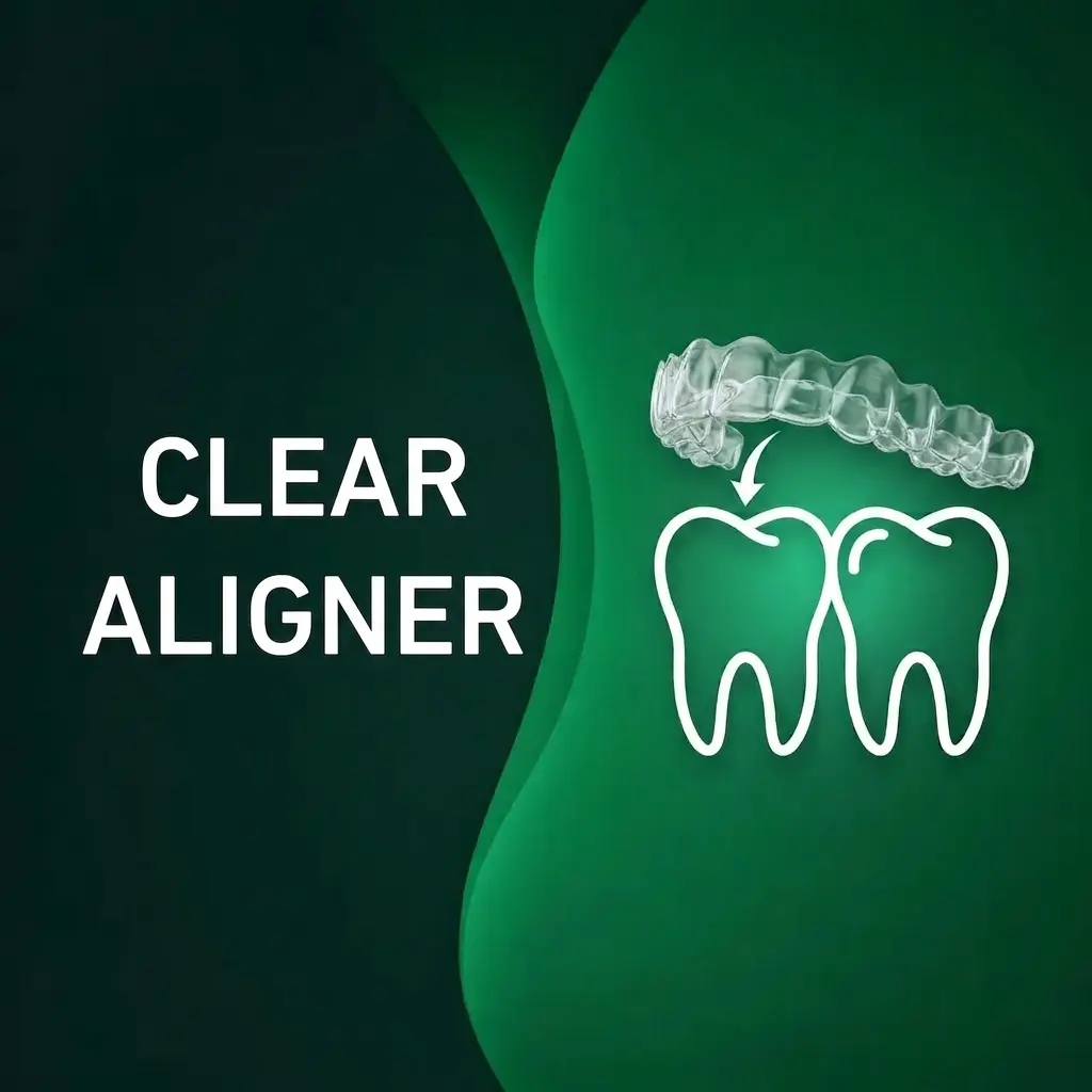 Clear Aligners