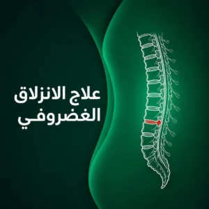 علاج الانزلاق الغضروفي (الديسك)